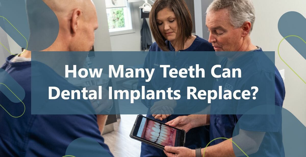 How Many Teeth Can Dental Implants Replace? Dentist Grove City OH